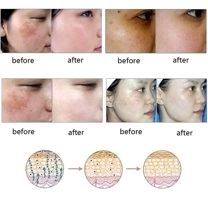 Dredge Meridian Skin Care Natural Pure Removal Acne Stretch Marks Scar Remova